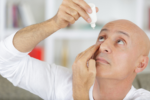 Man treating his dry eye